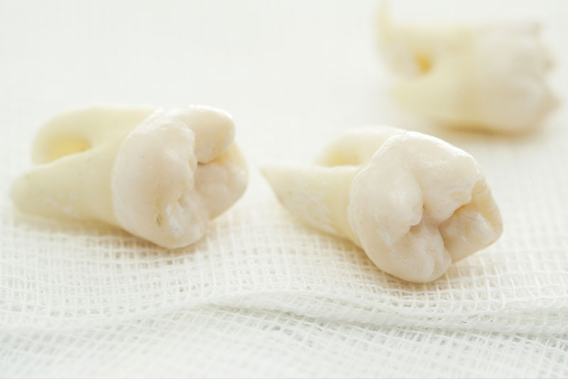 tooth model