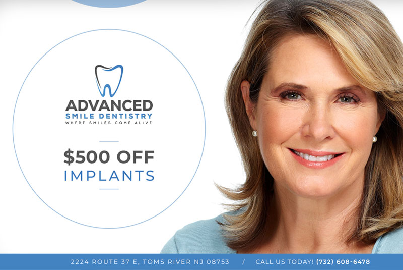 advanced smile dentistry coupon off 500 for dental implants