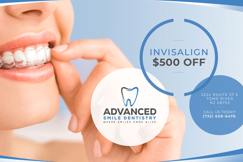 advanced smile dentistry coupon off 500 for invisalign