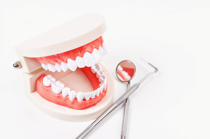 full mouth dental implant model and dental tools.