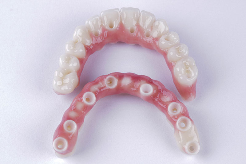 An image of a zirconia fixed bridge dental implant.