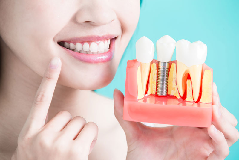 Are Dental Implants Like Natural Teeth In Toms River, NJ?