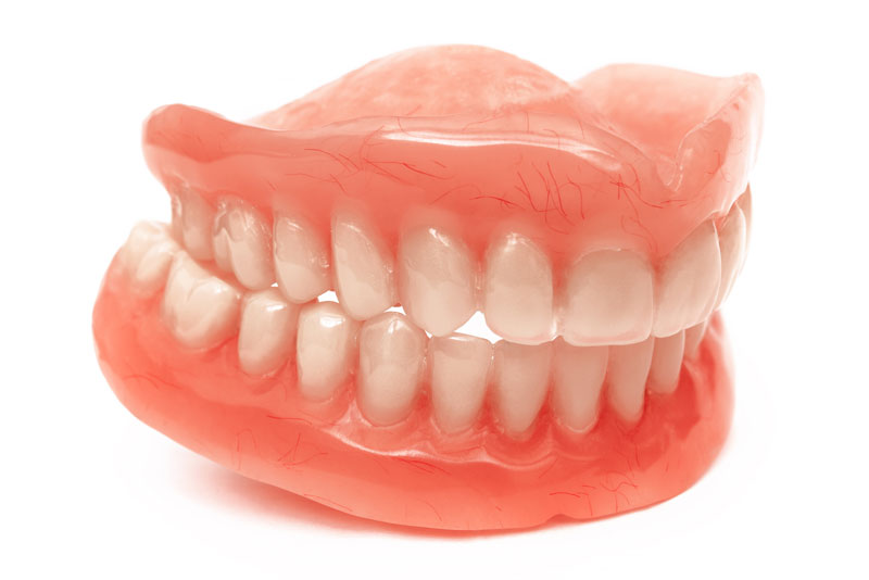 model of full mouth dental implants dentures