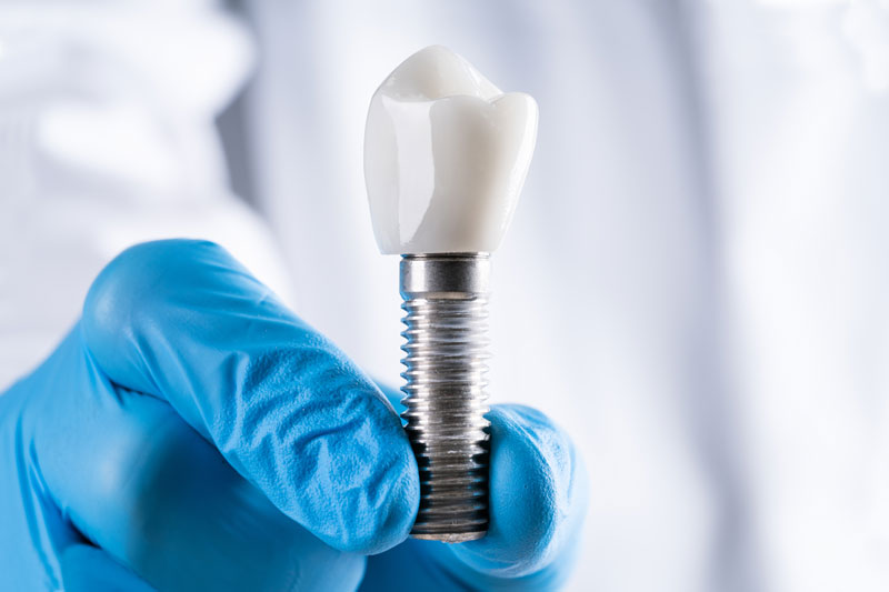 an experienced doctor holding up a single dental implant in his gloved fingers, one of the many dental implant options patients can get treated with.