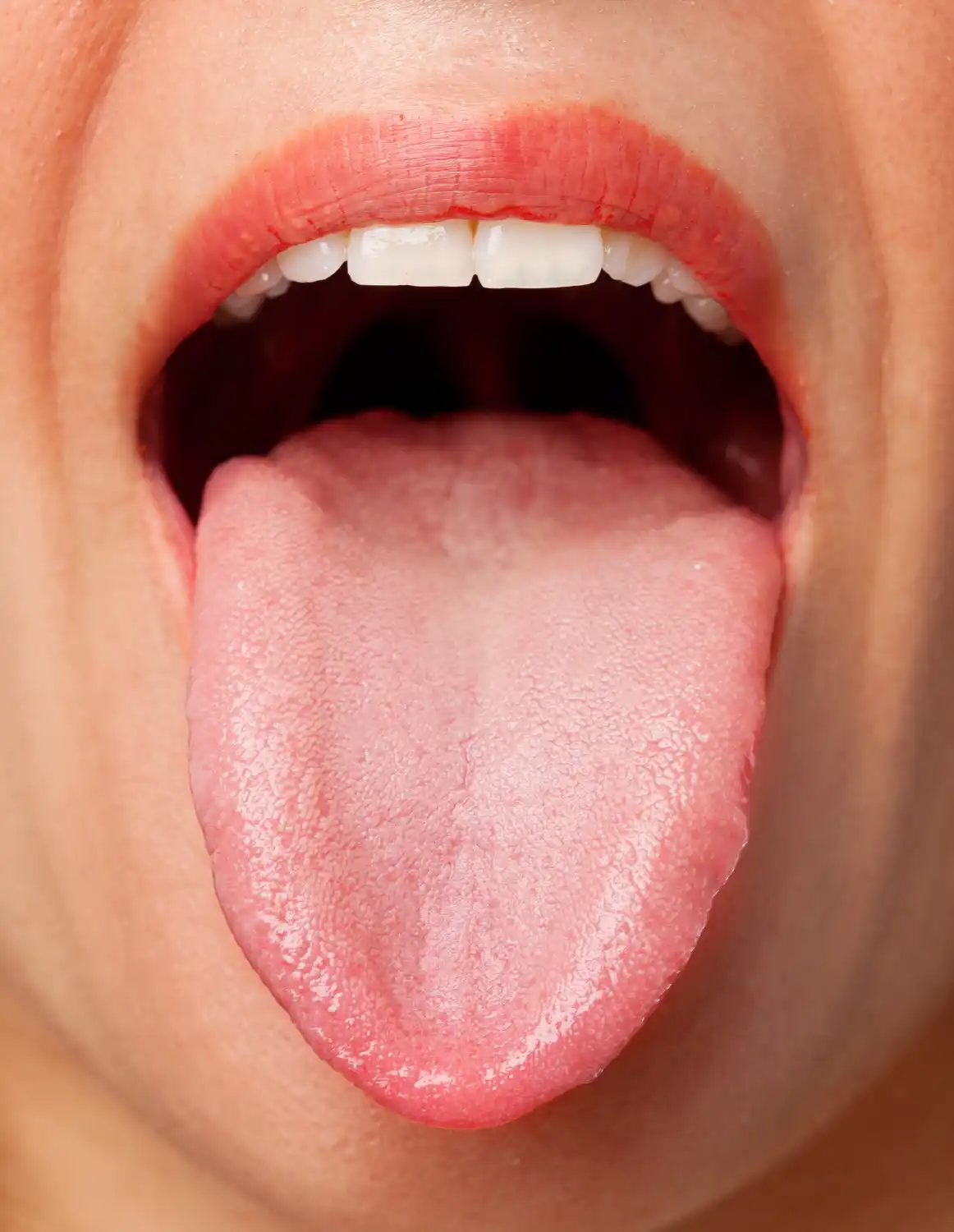 Mouth sores on tongue deals